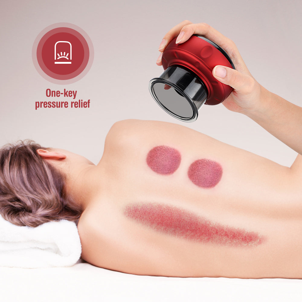 Cupping Therapy at Home: Benefits, How-To & What to Expect
